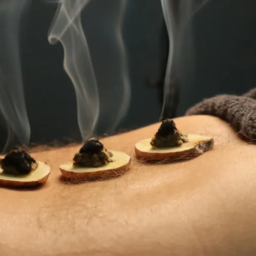 moxibustion